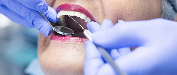 Best Emergency Wisdom Tooth Extraction in Fort Knox, KY